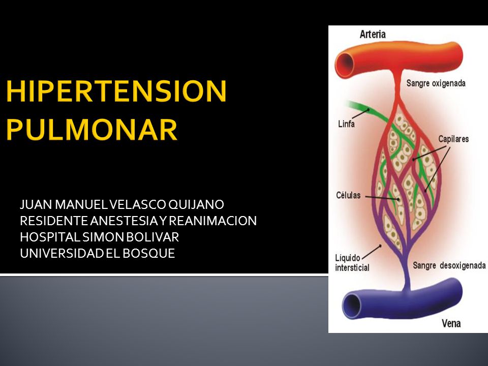 Causa de hipertensión venosa pulmonar